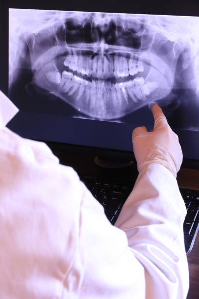 Best Emergency Root Canal Treatment in Penn State Erie, PA